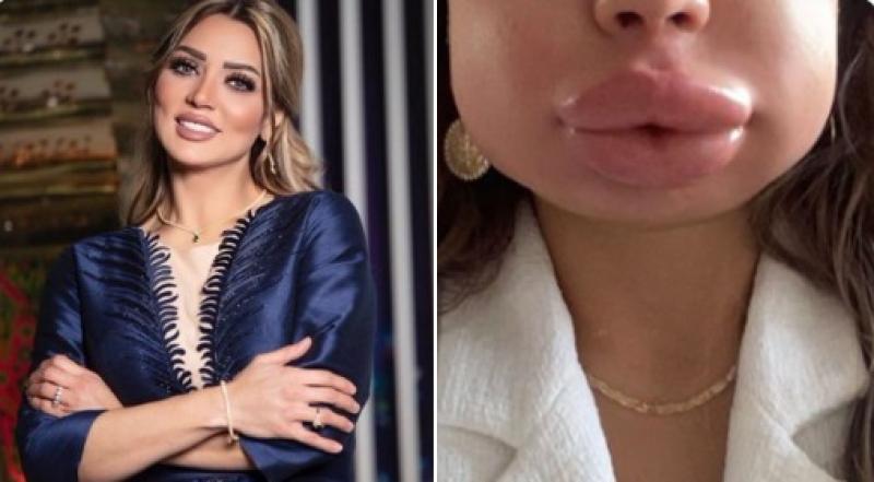 الفنانة عبير أحمد
