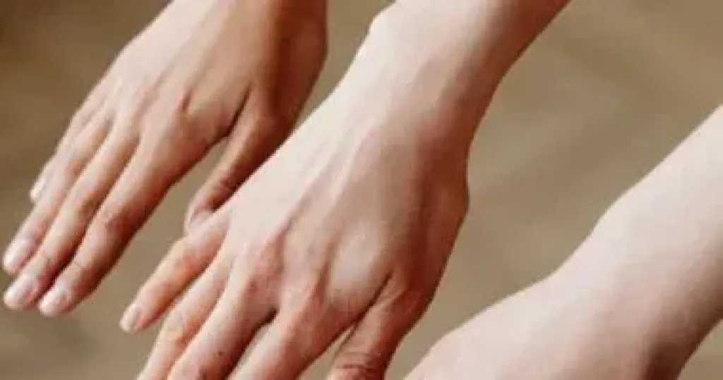 وصفات طبيعية لتفتيح اليدين فى الصيف