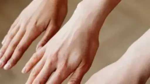 وصفات طبيعية لتفتيح اليدين فى الصيف