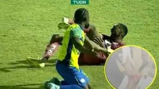 إصابة مأساوية للبرازيلي روماريو دا سيلفا في الدوري الهندوراسي