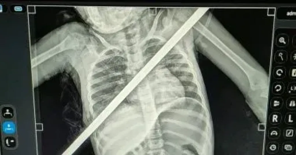 3 ساعات فى العمليات.
