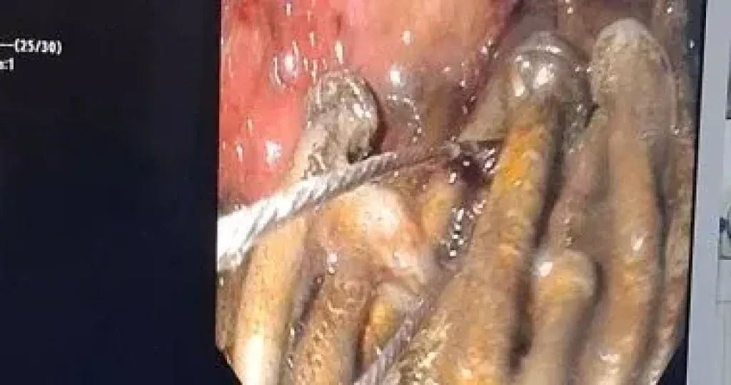 مستشفى جامعة بنى سويف